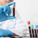 Lab Tests for PCOS