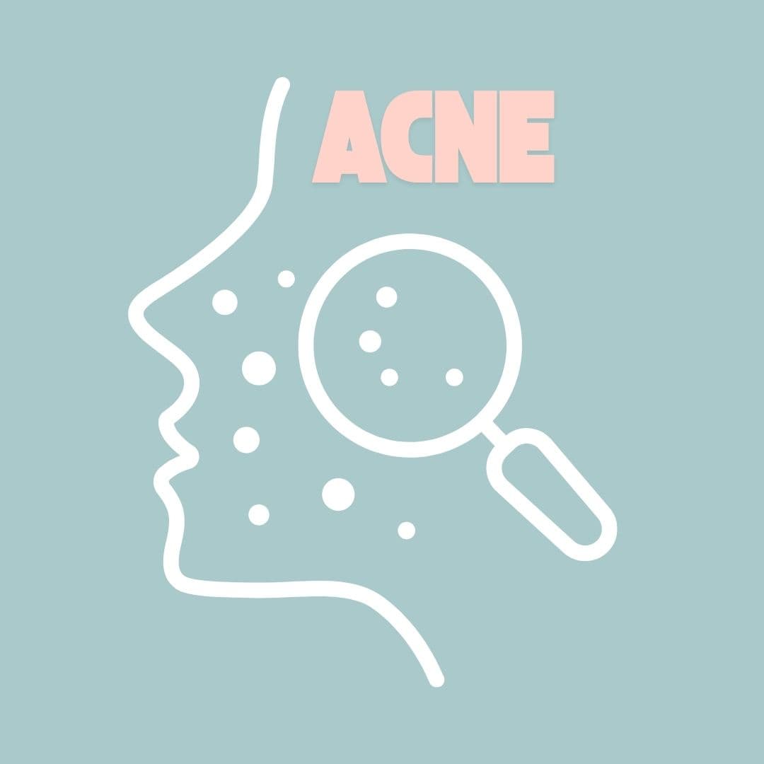 Persistent Acne: Natural Treatments for Chronic and Cystic Acne